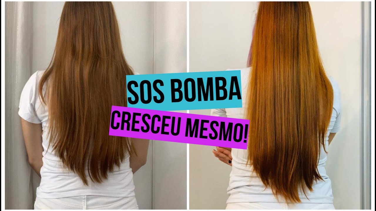 Antes e depois Mariana 29 anos - Kit SOS Crescimento